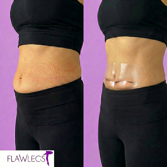 FlawSkin - Tummy